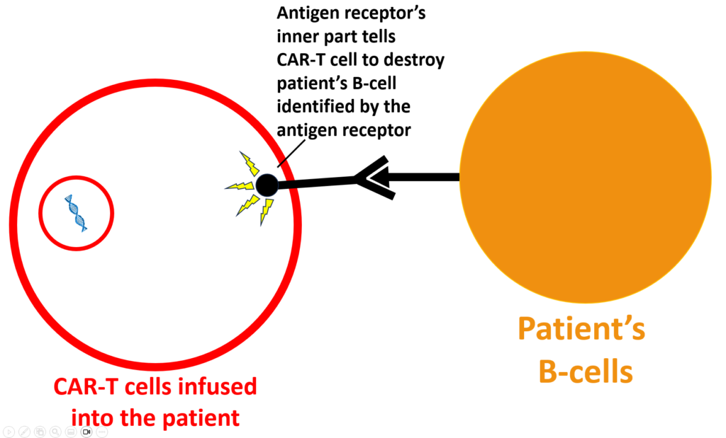 Car T Cell Therapy For Lupus Made Simple