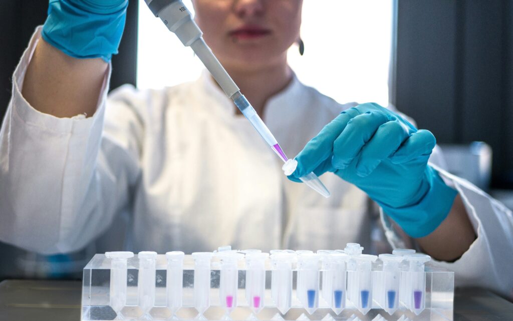 A lupus Coombs test being done in a lab