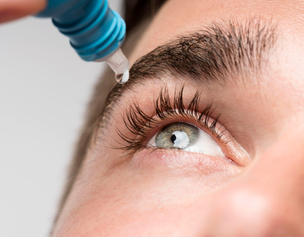 Woman using eye drops for dry eyes and lupus